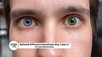 NATIONAL DIFFERENT COLORED EYES DAY  July 12
