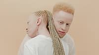 INTERNATIONAL ALBINISM AWARENESS DAY | June 13