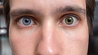 NATIONAL DIFFERENT COLORED EYES DAY  July 12