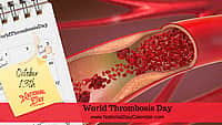 World Thrombosis Day - October 13