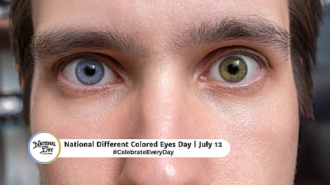 NATIONAL DIFFERENT COLORED EYES DAY  July 12