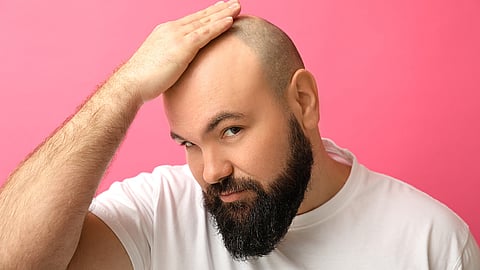 Be Bald And Be Free Day