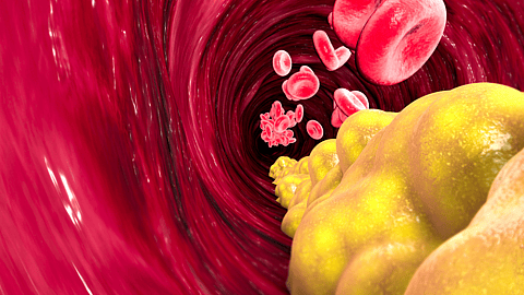 National Triglyceride Day | March 28