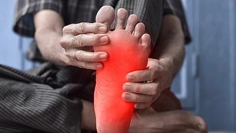 NECROTIZING FASCIITIS AWARENESS DAY  May 31