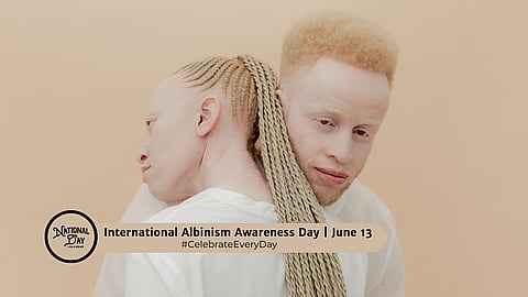 INTERNATIONAL ALBINISM AWARENESS DAY | June 13