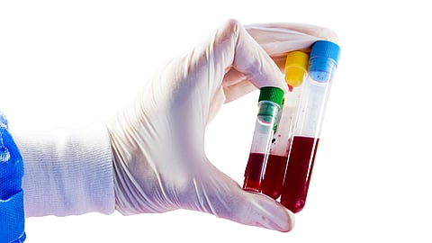INTERNATIONAL PATHOLOGY DAY | Second Wednesday in November