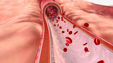 NATIONAL LIPID DAY  May 10