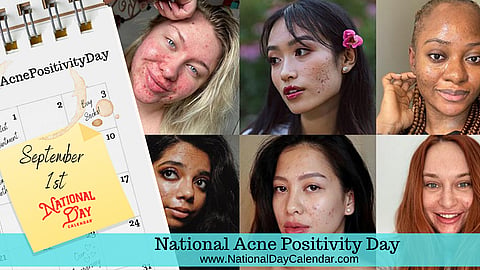 National Acne Positivity Day - September 1