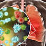 World Pneumonia Day