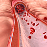 NATIONAL LIPID DAY  May 10