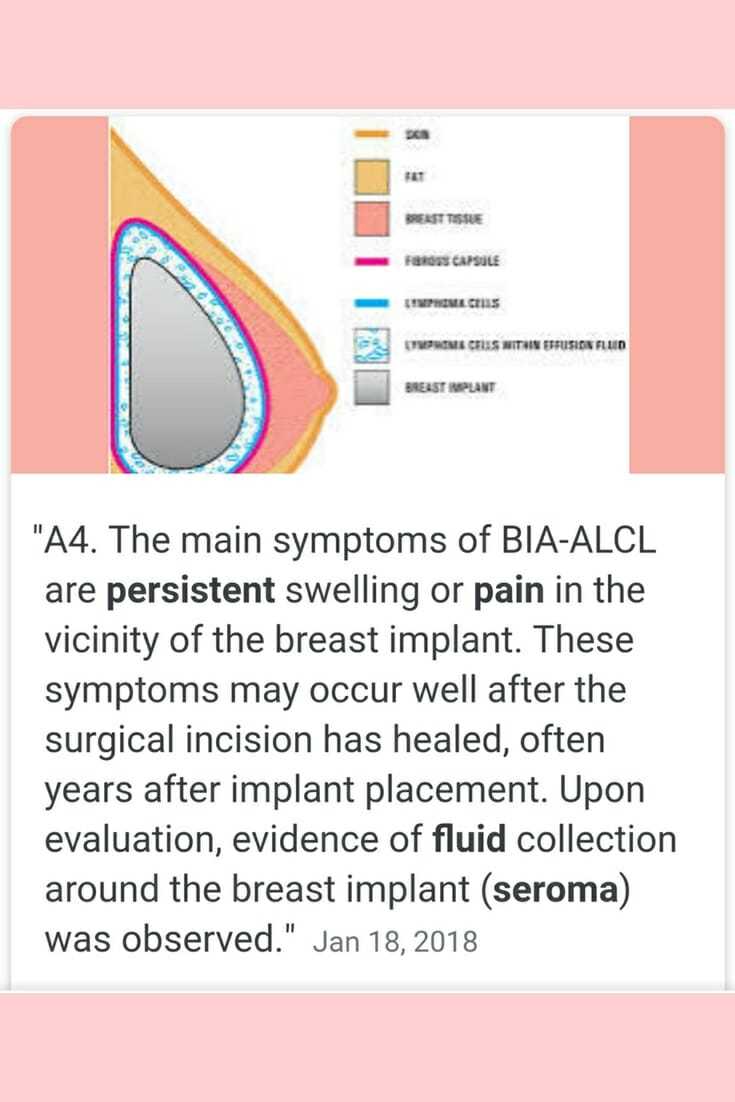 National Breast Implant Awareness Month - Graphic