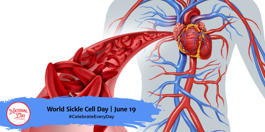 World Sickle Cell Day | June 19